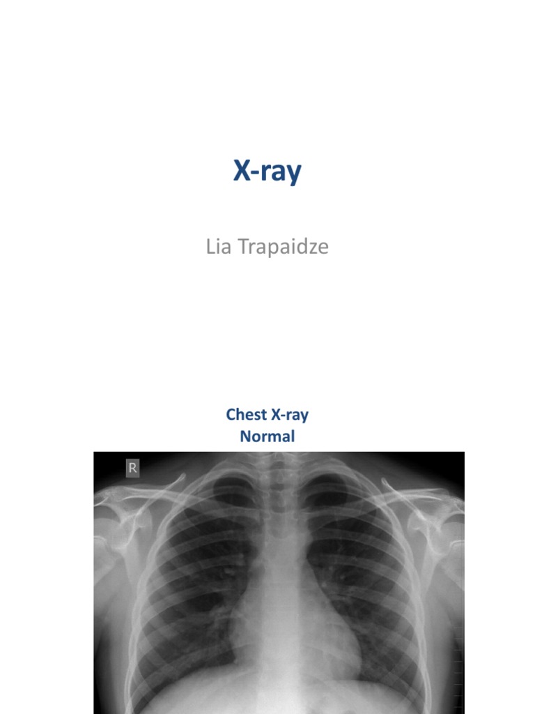 X - Ray | PDF