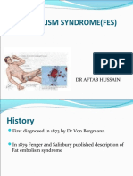 Fat Embolism Syndrome (Fes) : DR Aftab Hussain