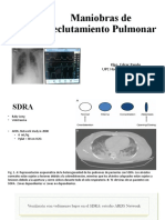 Maniobras de Reclutamiento Pulmonar en SDRA