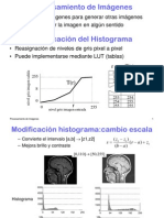 Histograma Modificacion