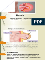 Hernia