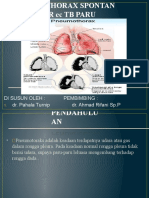 Pneumothorax 2