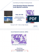 Molecular Minimal Residual Disease Detection in Acute Myeloid Leukemia