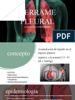 Derrame Pleural