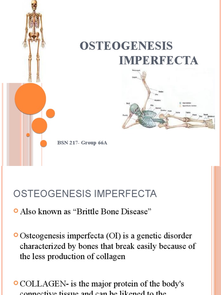 Understanding Osteogenesis Imperfecta A Comprehensive Review of the