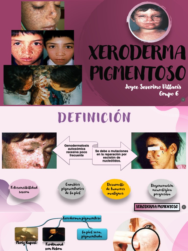 Xeroderma Pigmentoso | PDF | Mutación | Reparación de adn