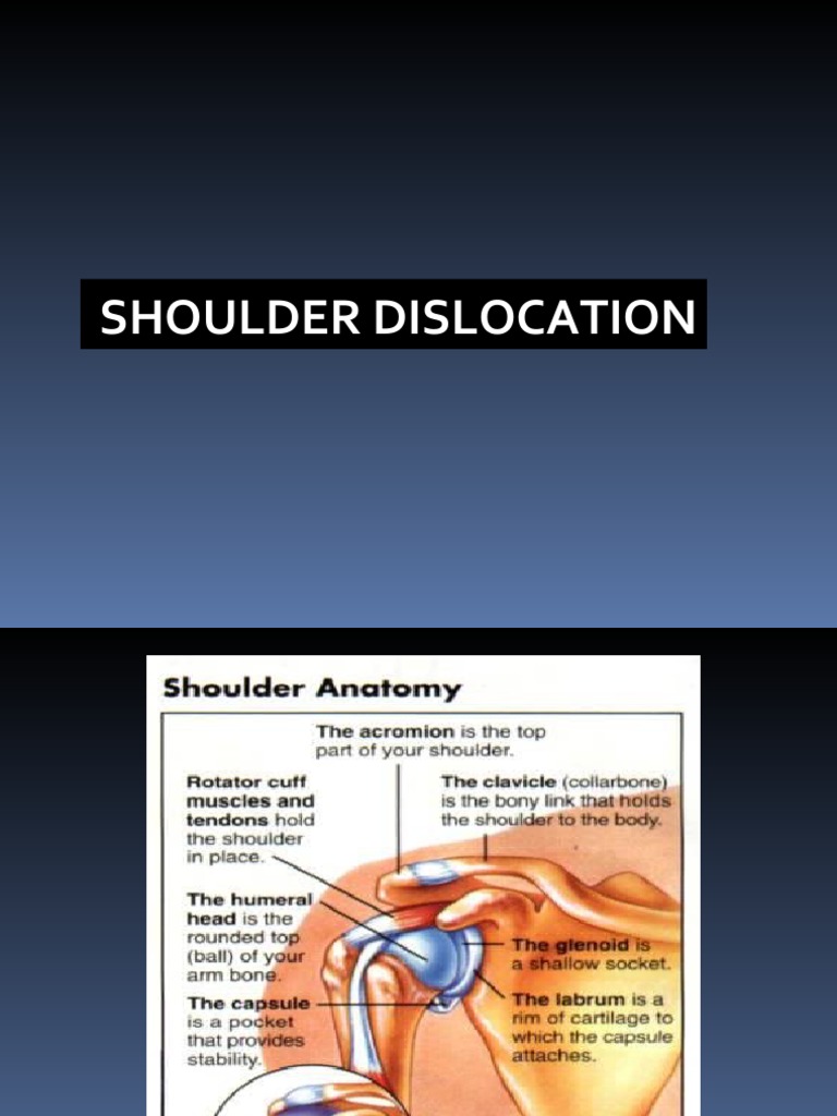 Shoulder Dislocation Diagnosis and Treatment | PDF | Shoulder ...