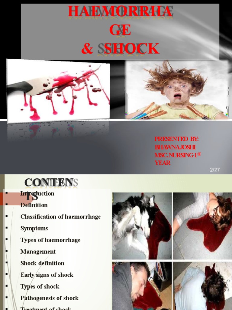 Hemorrhage and Shock Management Guide | PDF | Shock (Circulatory ...