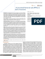 Modes of Failure of Proximal Femoral Nail (PFN) in Unstable Trochanteric Fractures