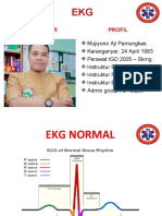 EKG Normal
