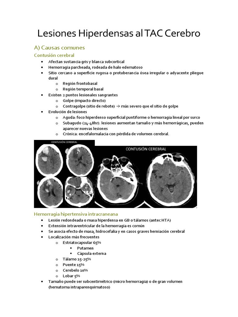 lesiones-hiperdensas-en-tac-cerebral-pdf-cerebro-neuroanatom-a
