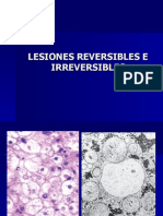 Lesiones Reversibles e Irreversibles 2008-2