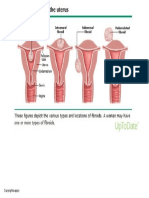 Fibroid Anatomy