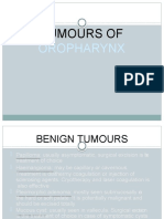 Tumours Of: Oropharynx