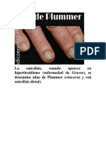 Uñas de Plummer PDF