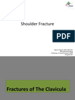 modul shoulder fracture 4,9,19.pptx