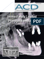 Immediately Loaded Pterygoid Implants: All On 4 With Laser Narrow Made Implants