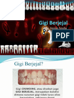 Gigi Berjejal