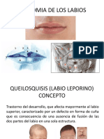 Anatomía y tratamiento del labio leporino