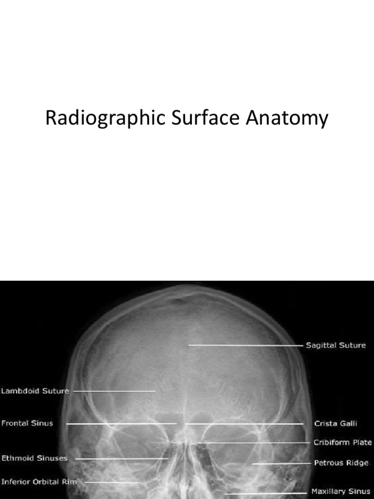 Radiographic Surface Anatomy Guide | PDF | Wellness