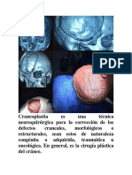 CRANEOPLASTIA