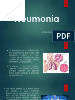 PRESENTACION DE NEUMONIA (MARIO VALDES).pdf