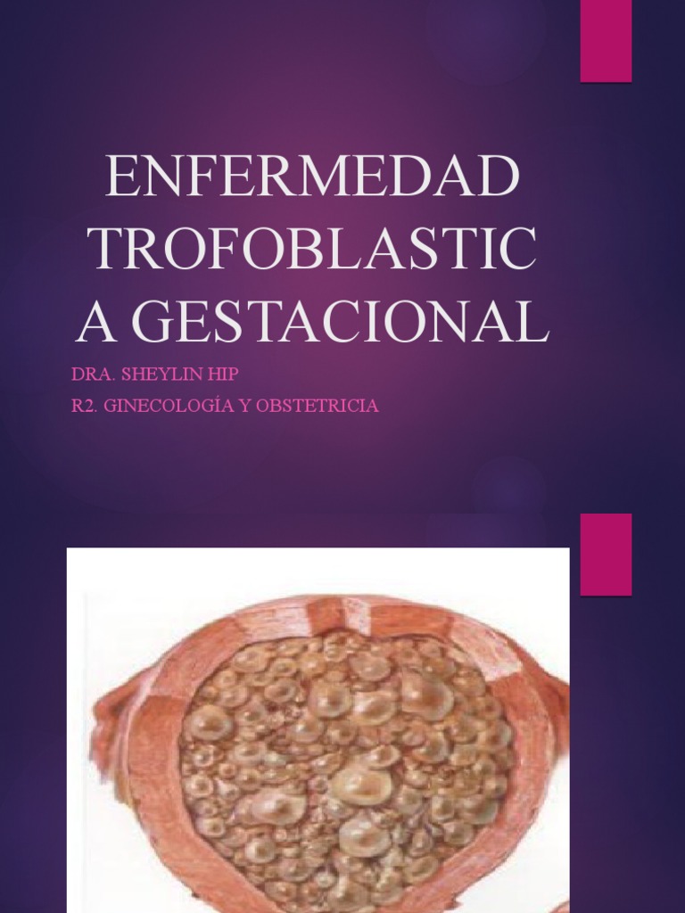 Enfermedad Trofoblastica Gestacional | PDF | Gonadotropina coriónica