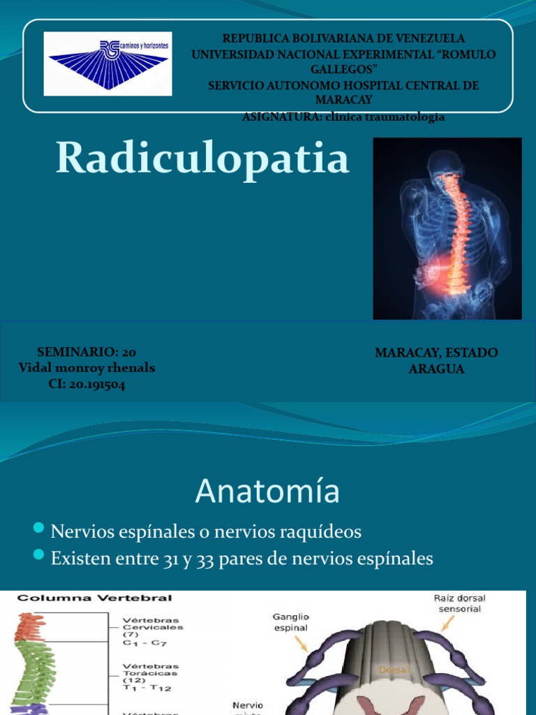 Radiculalgia Y Radiculopatía – Dolor Cervical y Radiculopatía, estudio ...