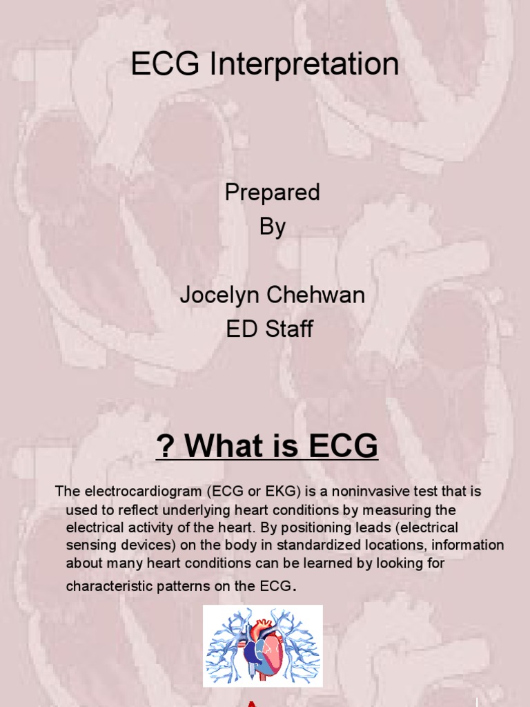 ECG Interpretation Guide | PDF | Atrium (Heart) | Heart
