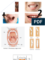 Edukasi Gigi Anak