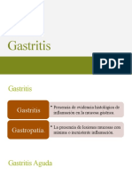 Gastritis y úlcera péptica