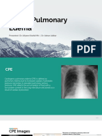 Cardio Pulmonary Edema