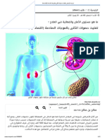 جريدة الرياض - تفتيت حصوات الكلى بالموجات الصادمة (التصادمية)