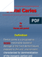 Dental Caries: by DR: Hanan Eid Gamal