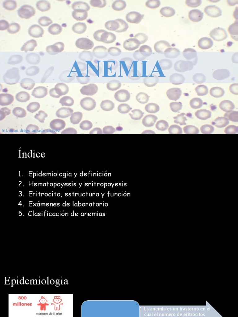 Clasificación y tipos de anemia | PDF | Glóbulo rojo | Anemia