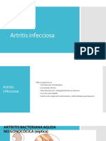 Artritis Infecciosa