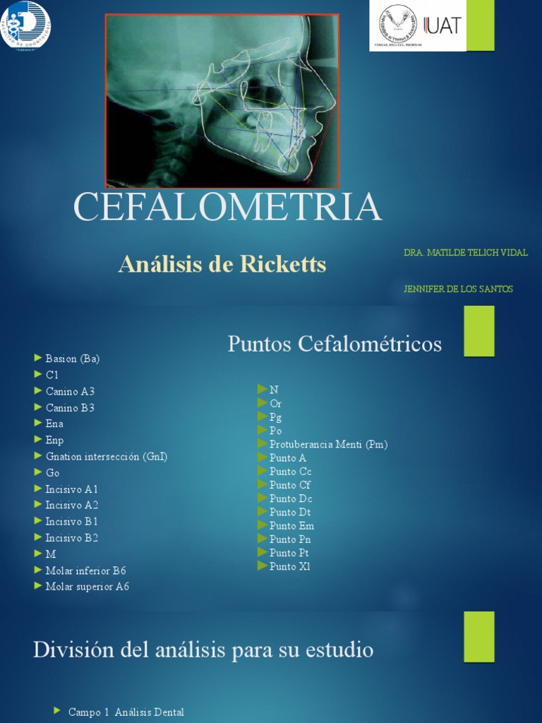 Cefalometria De Ricketts Completo – MDSPE