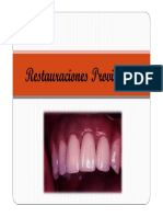 Restauraciones Provisorias en Protesis F