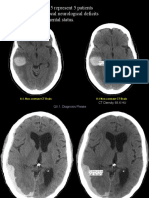 Figures 8.1 Through 8.5 Represent 5 Patients Who Presented With Focal Neurological Deficits and Acute Change in Mental Status