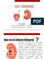 Litiasis Urinaria: Causas, Síntomas y Tratamiento