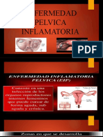 Enfermedad Pelvica Inflamatoria