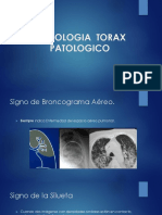 Radiologia Torax Patologico