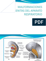 malformacionescongenitasdelaparatorespiratorio HOY 2016.pptx