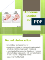 Abnormal Uterine Contraction 