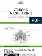 CT Scan Nasofaring