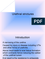 Urethralstrictures