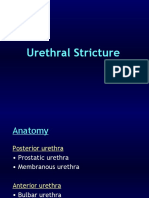 Uro Urethralstricture