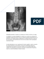 Urografia 1