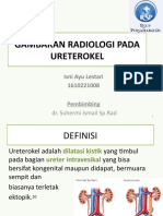 Gambaran Radiologi Pada Ureterokel