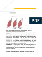 Tuberculose: Doença Infecciosa Pulmonar